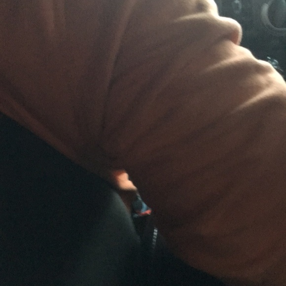 My dads arm - Picture 1 of 1